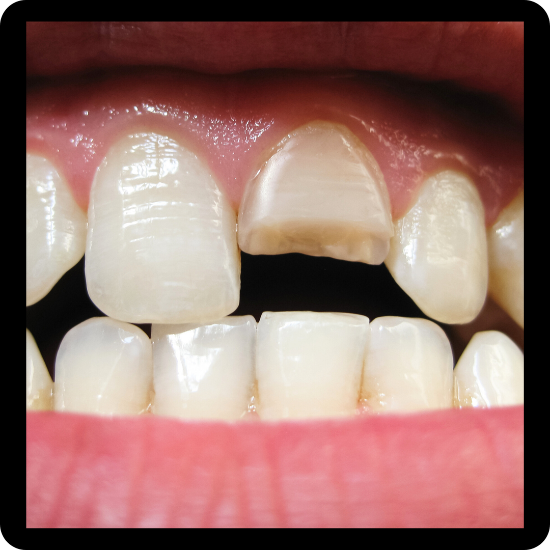 Buy your kit and choose your assessment