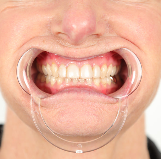 d.MISTIFY Capture Kit