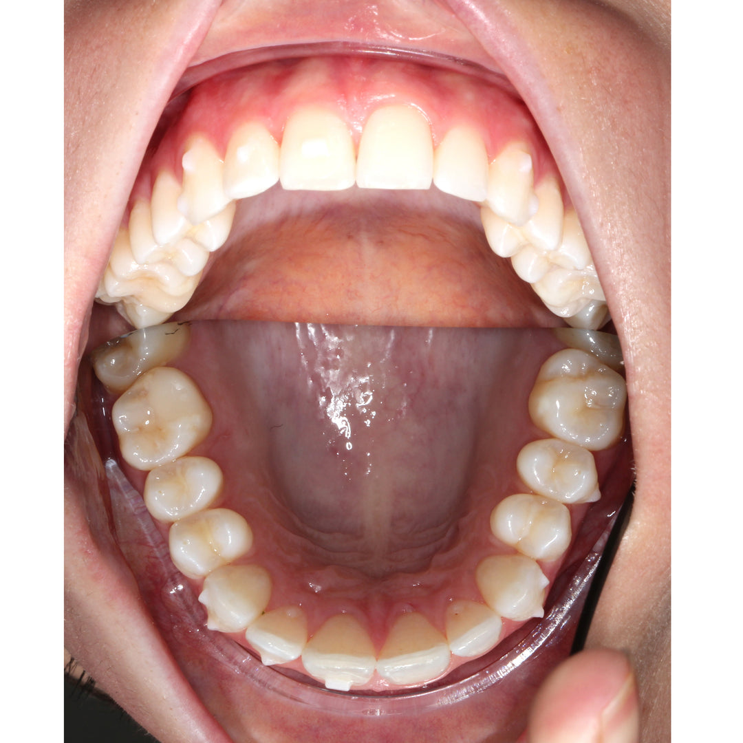 d.MISTIFY Capture Kit