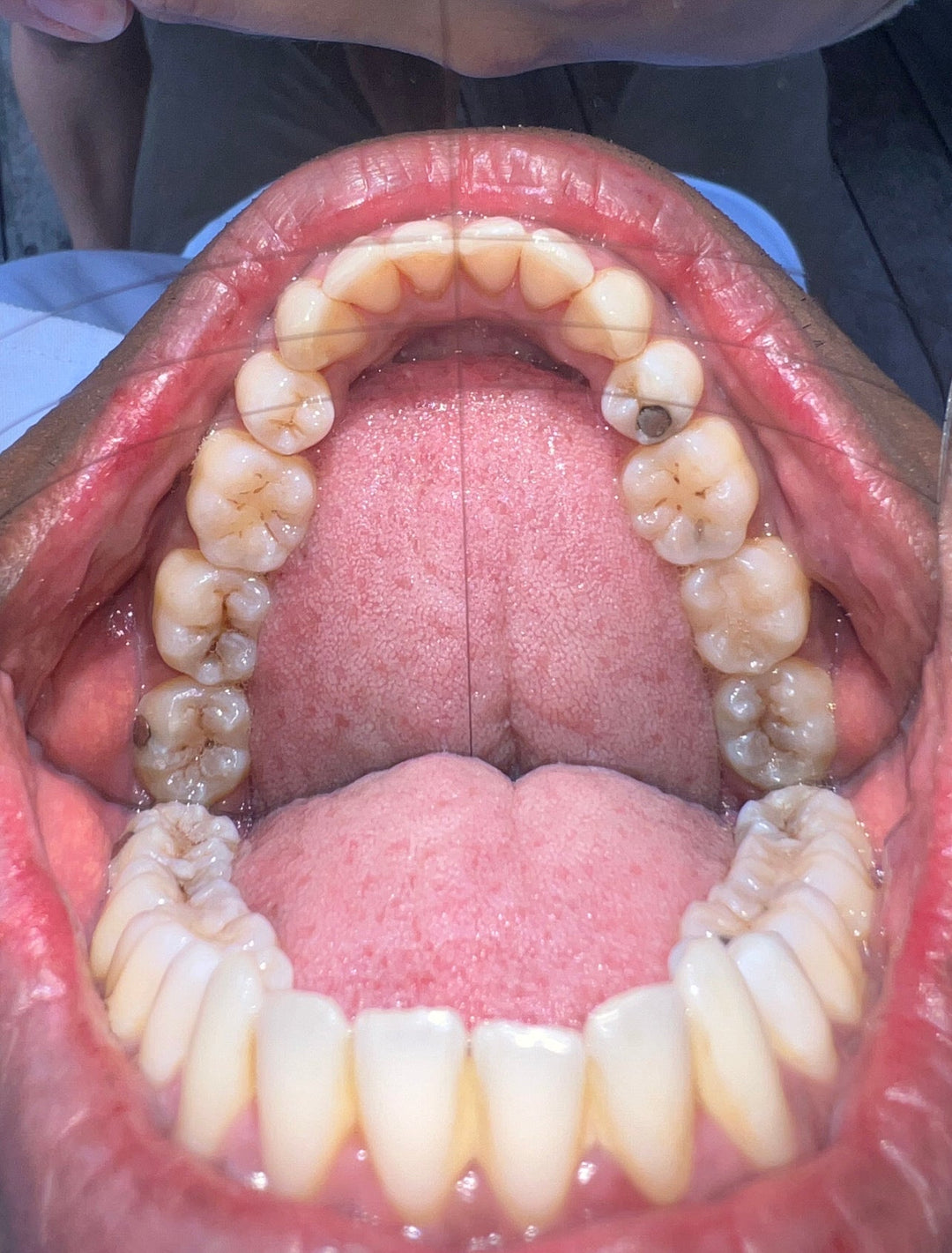 d.MISTIFY Capture Kit