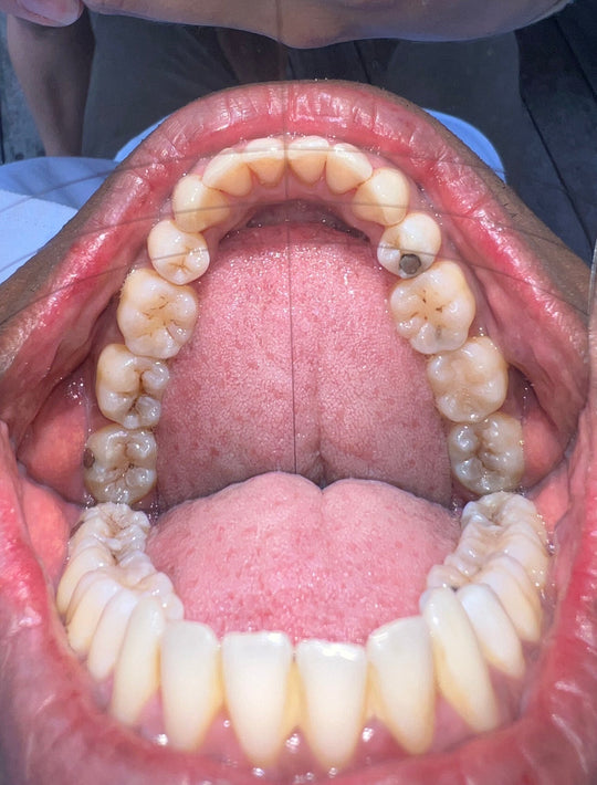 d.MISTIFY Capture Kit