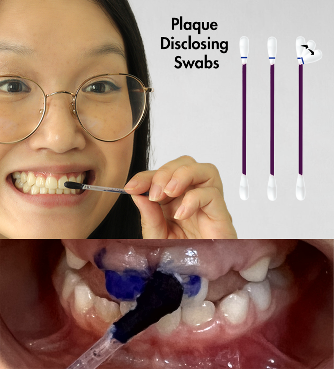 Divulge Plaque Disclosing Swabs